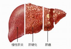 广州送菜公司了解富川富阳镇千亩蔬菜种植基地助农增收
